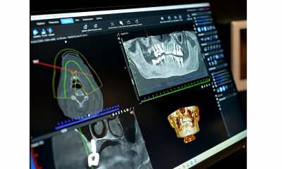 Extracțiile Dentare: Ghid Complet – Când Sunt Necesare, Cum să Te Pregătești și Ce Opțiuni Ai
